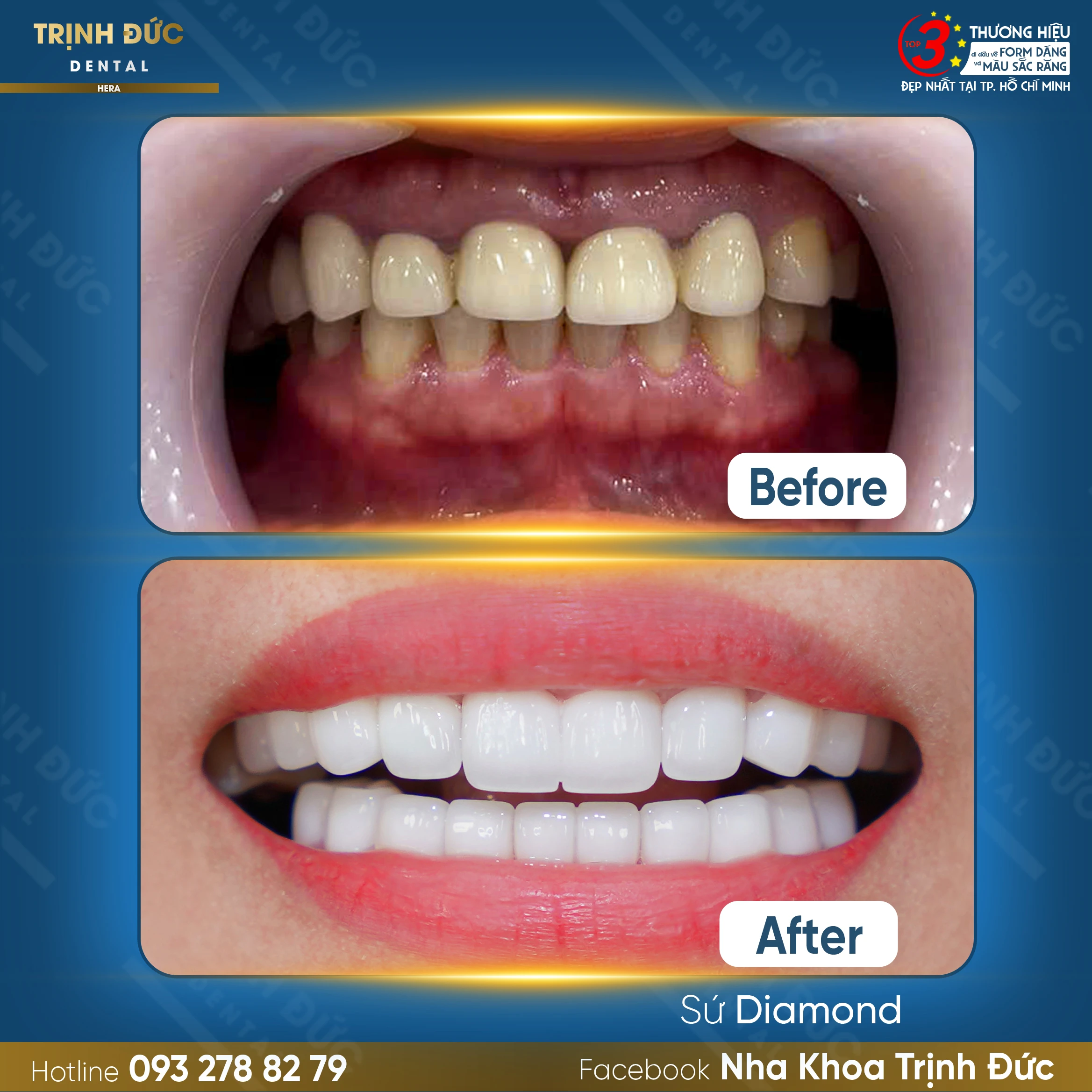 Trịnh Đức Dental – Nơi mỗi nụ cười là một phiên bản cao cấp được thiết kế để bạn toả sáng.
