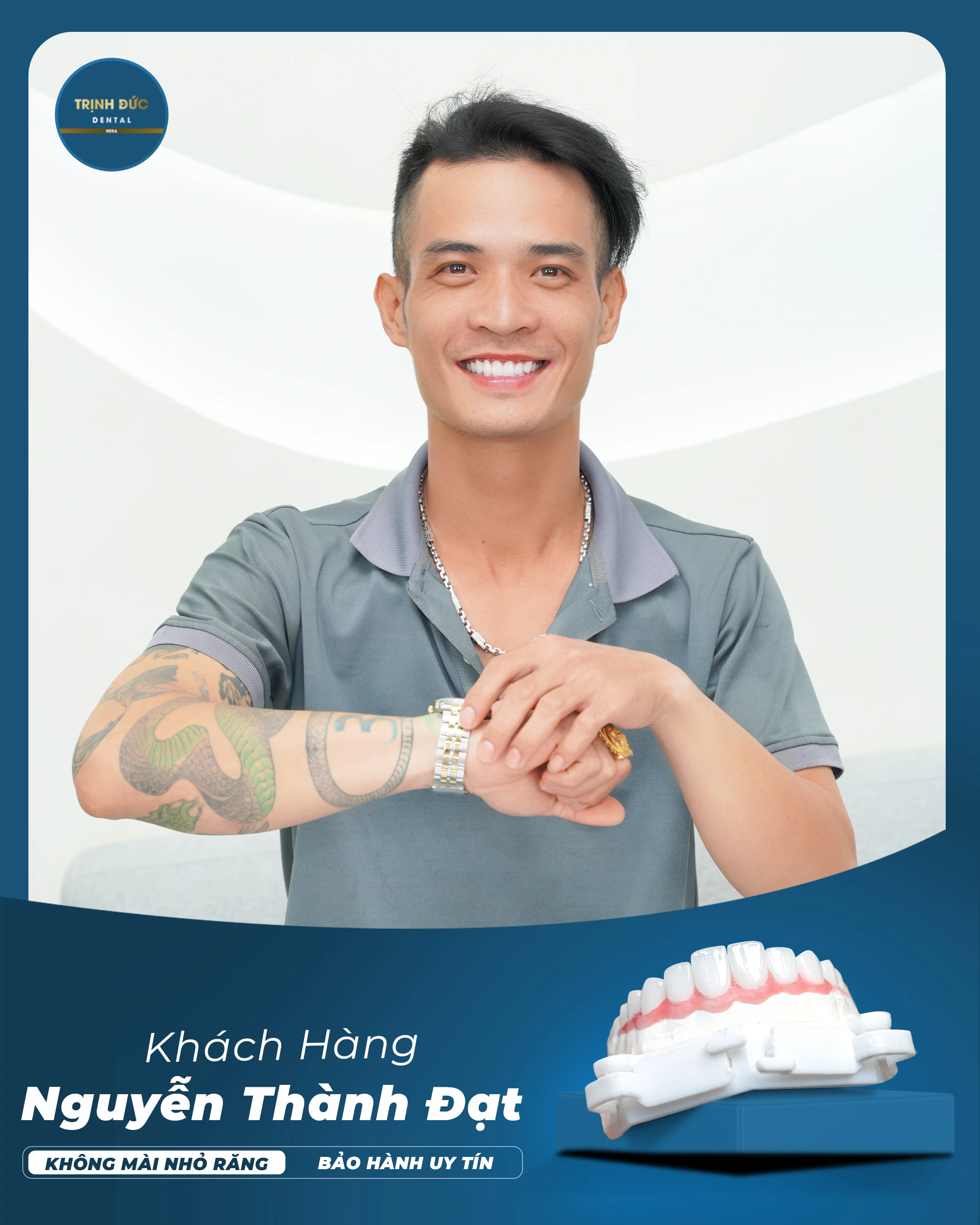 Răng sứ cho nam giới