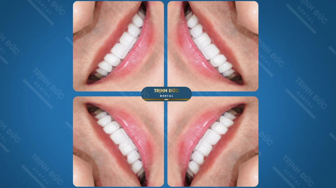 PHÁI NAM HAY PHÁI NỮ ĐỀU GIỐNG NHAU, ĐỀU CẦN CHĂM CHÚT CHO NGOẠI HÌNH