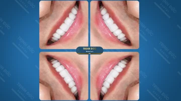 PHÁI NAM HAY PHÁI NỮ ĐỀU GIỐNG NHAU, ĐỀU CẦN CHĂM CHÚT CHO NGOẠI HÌNH