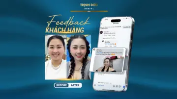 “Trộm vía ai cũng khen đẹp” – Hành trình làm răng sứ thẩm mỹ giúp chị Syn Huỳnh tỏa sáng trong ngày cưới